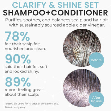 Apple Cider Vinegar Shampoo and Conditioner Set